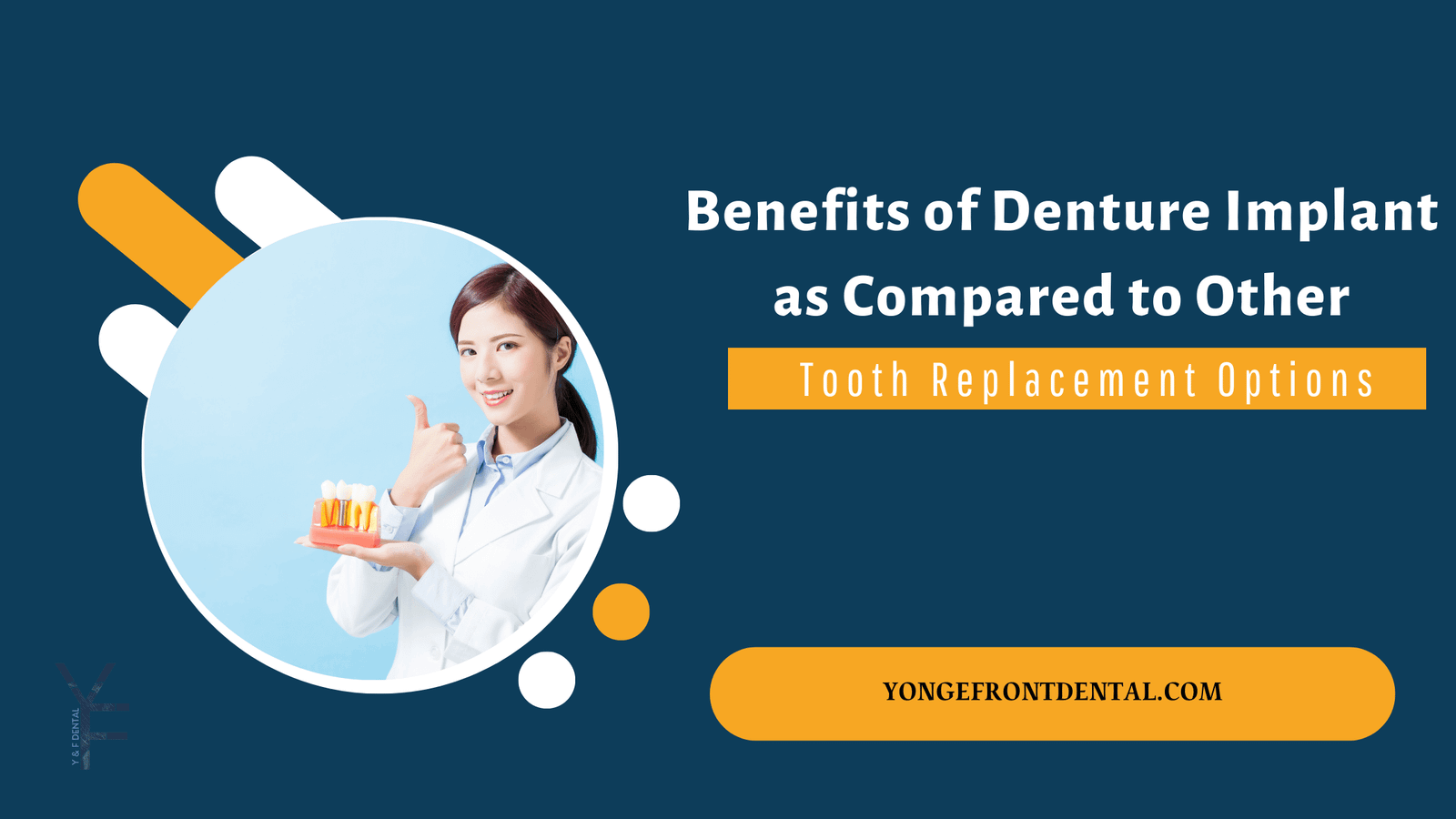 Benefits of Denture Implant as Compared to Other Tooth Replacement Options
