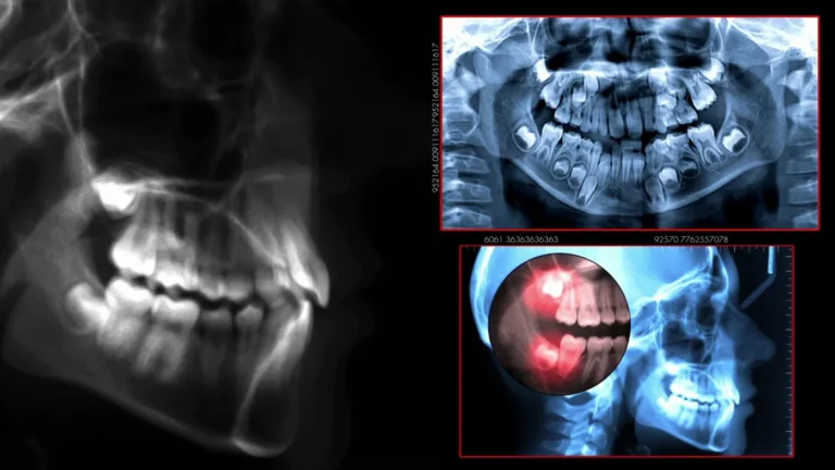 Patient with a toothache holding their cheek