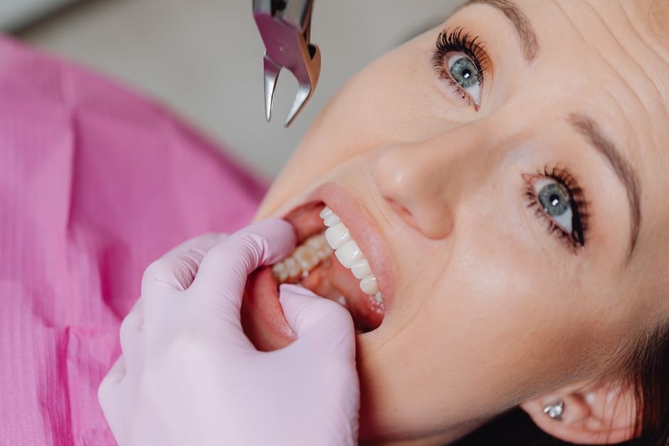 Wisdom Tooth Pain Relief Toronto: When to See an Emergency Dentist