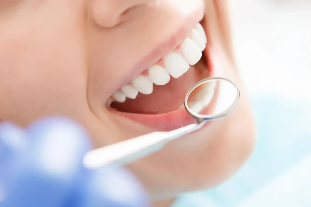 Smiling woman with bright white teeth after ZOOM! teeth whitening